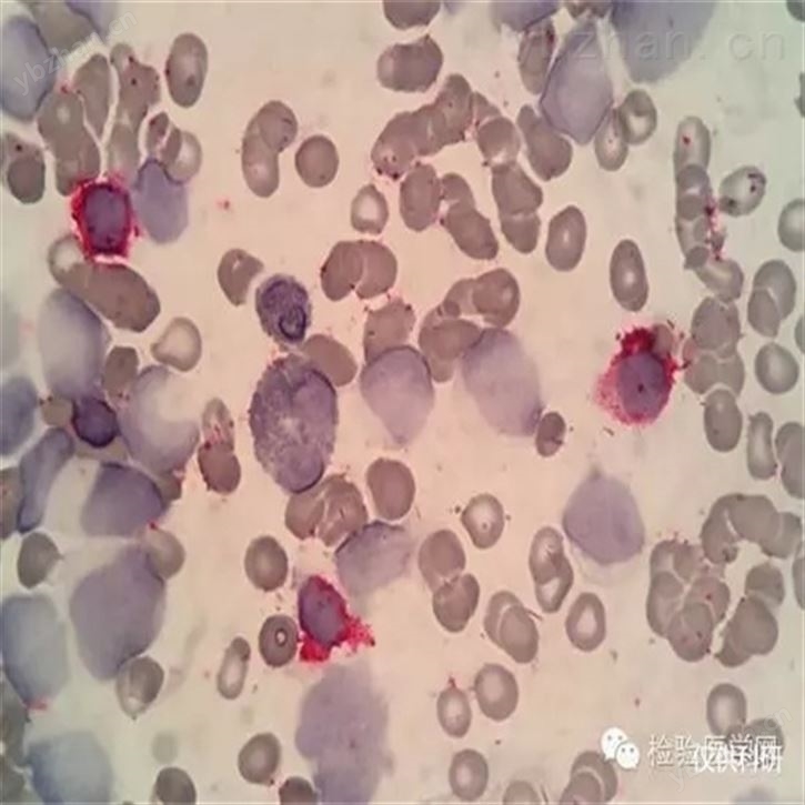 原代NK細胞培養體系